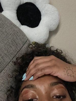 You can see how red it is and super painful