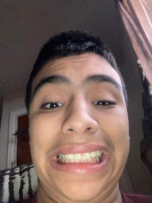 Via Metropolitan Transit