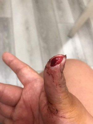 They were careless when cleaning my wound