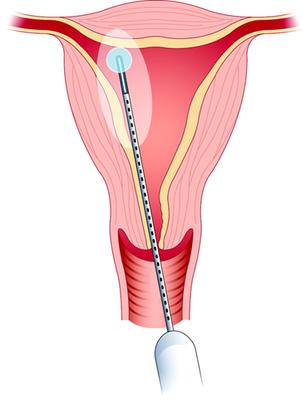 Special Care for Women: Braden Richmond, MD