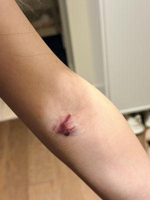 Any Lab Test Now Redmond