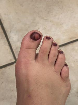 My gel toe nail polish from same day. So pissed off!!