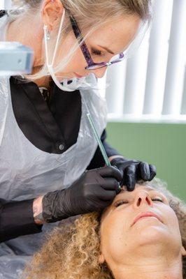 The tapping method is used, not the microblading method, it's very precise, and healing is quick.