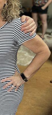 After. Much smaller arms and no back fat.