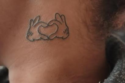 Blast4ME Ink Therapy