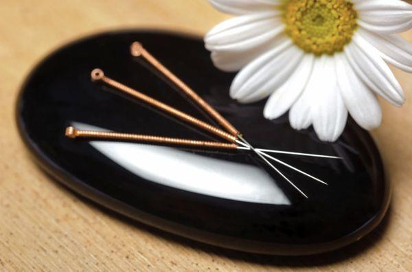 Heart and Harmony Acupuncture