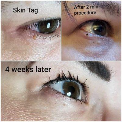 Adriana's Professional Body Sugaring