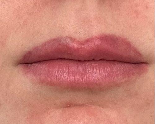 Lips