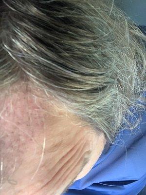Hair By Dr. Max, Restoration Center