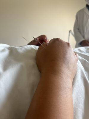 Sun's Acupuncture Reqi