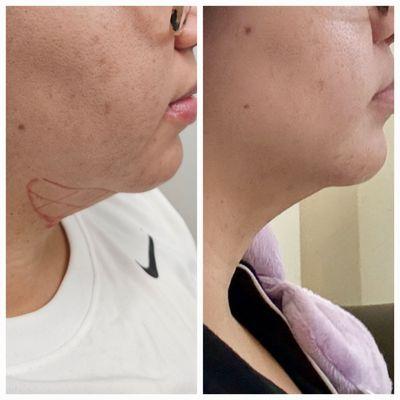 TruBody Wellness & Aesthetics