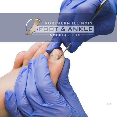 Northern Illinois Foot & Ankle Specialists