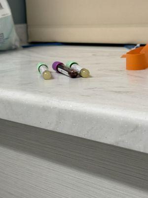 Vials of blood left unused on the counter for an hour.