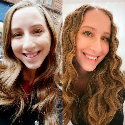 Invisalign before and after - 2 year treatment.