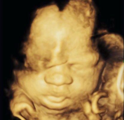 Dr. Marlene Kalouyan