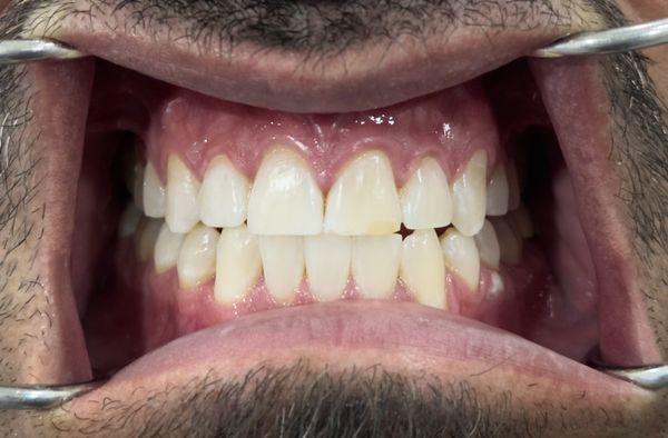 Duke City Dental & Hygiene