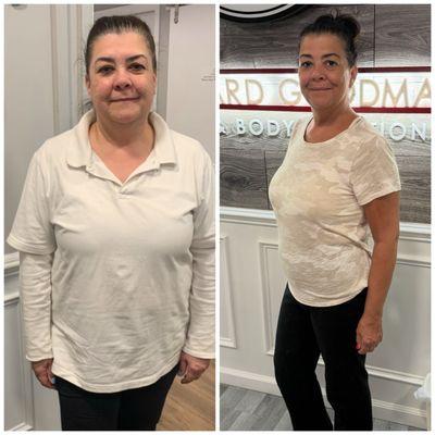 Long Island Weight Loss Doctor