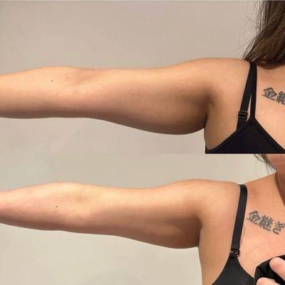 Targeted Area Sculpt