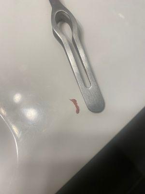 Left behind wisdom tooth bone