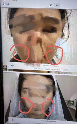 The picture on the top shows the condition before treatment, while the one below shows the condition after treatment