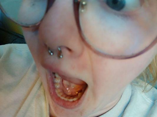 A very silly picture that also shows that my piercing is way too low. If you look closely you can see it protruding out of my septum.