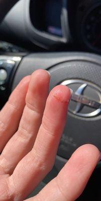 Cut on finger from power drill