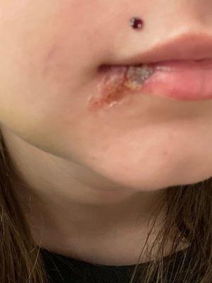 What it looked like after a couple of days.