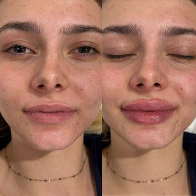 Glam Medispa