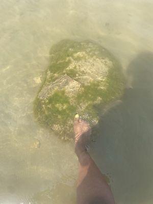 Campbell County Health