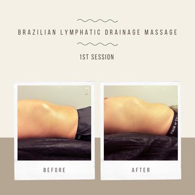 #brazilianlymphaticdrainage