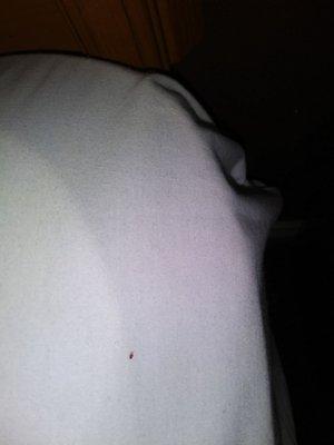 Pic of bug that i found in the bed