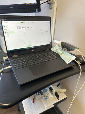 New digital scanners for making crowns, with shorter delivery times.