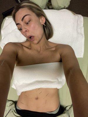 Peace of Zen Acupuncture