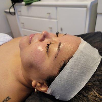 Hydro facial