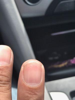 Worst manicure I ever had. I wish I could show you my toes also. Review is coming!