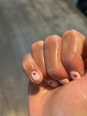 Still swollen from her cutting too deep.