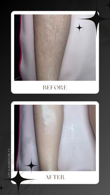 Before and after of a lower leg wax