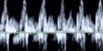 Tiny Treasure Imaging