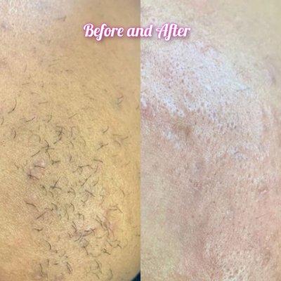 By Distinction Only Electrolysis Studio