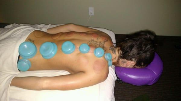Tried cupping for the first time. It was great! You could actually feel the massage going deeper once the cups were removed.