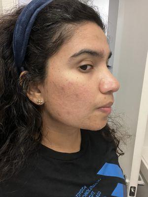 Sangini Patel, M.S, PA-C - Liv Aesthetics Chicago