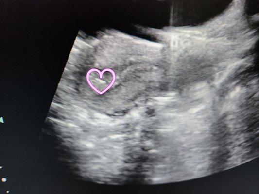 UHealth Fertility Center