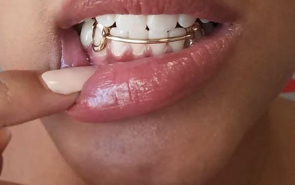 https://calendly.com/bossladygrillz/gold-teeth