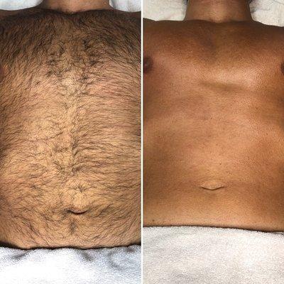 Men waxing: chest/stomach