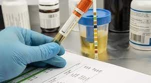 Drug Testing Services