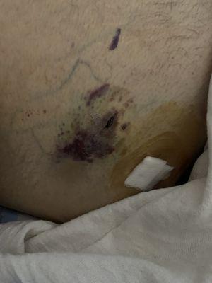 This hospital is the worst by far! they botch procedures. with rude nurses! everything was a hassle for them. rolling eyes and all.