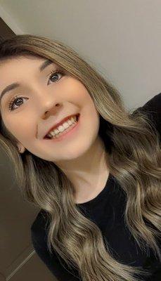 After braces were taken off!!