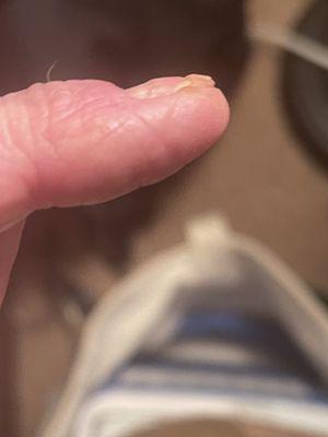 This is a side view of my index finger