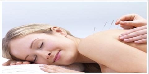 Unsook Park’s Acupuncture