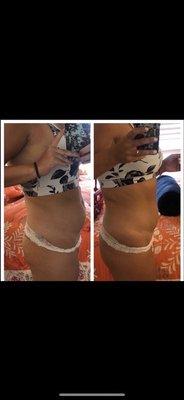 Before and after 4 weeks, one session